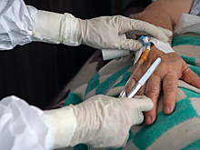 Названы семь возможных видов сыпи от COVID-19