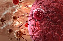 Ученые назвали главную ошибку при лечении раковых опухолей