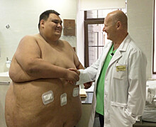 Петербургские хирурги провели операцию 251-килограммовому пациенту: через год его вес должен приблизиться к норме