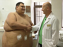 Петербургские хирурги провели операцию 251-килограммовому пациенту: через год его вес должен приблизиться к норме