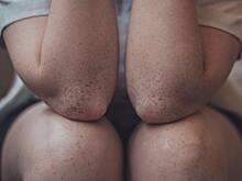 Мясников рассказал, что нужно для здоровья суставов