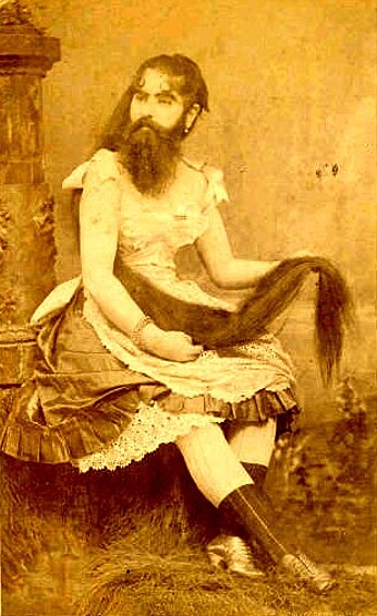 Энни Джон (1865—1902 гг.) родители отдали в цирк в девятимесячном возрасте. За выступления платили 150 долларов в неделю. К пяти годам у нее появились усы и бакенбарды, а в зрелом возрасте ее волосы выросли до 180 см. Энни дважды выходила замуж, но о детях упоминаний не сохранилось.