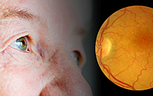 Найдены ответственные за слепоту у пожилых людей клетки