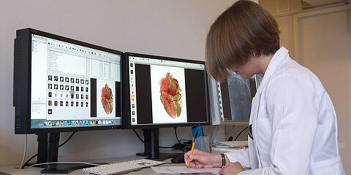В России может появиться первый онлайн-счетчик операций по трансплантации органов