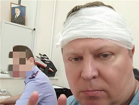 В прокуратуре опровергли слова депутата Матвеева о смягчении обвинения для напавших на него мигрантов