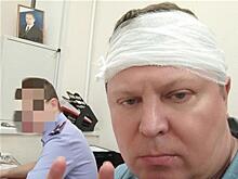В прокуратуре опровергли слова депутата Матвеева о смягчении обвинения для напавших на него мигрантов