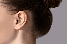 Почему возникают трещины за ухом