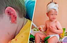 В детсаду Екатеринбурга 2-летнему малышу насквозь проткнуло ухо палкой