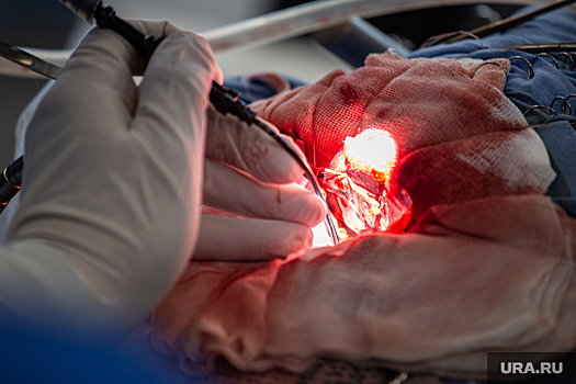 В ХМАО хирург провел сразу три операции вместо одной, чтобы спасти пациента