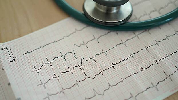 Кардиолог Васильев: К 2030 году смертность от инфаркта может достичь 25 миллионов случаев в год