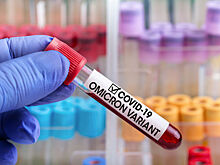 ВОЗ заявила об отсутствии смертей от «омикрона»