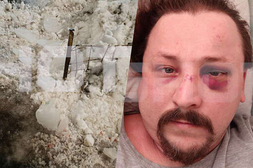 SHOT: в Самаре мужчине на голову рухнула льдина после выхода из подъезда