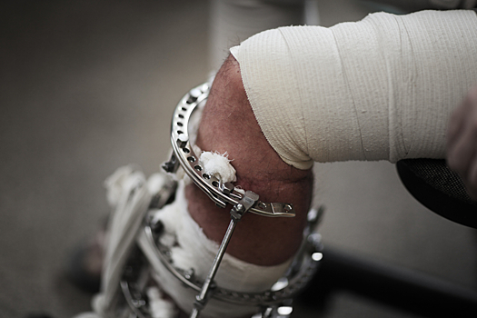 b81517b3230e76c512fdddc0c3c61b27