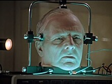 Пересадка головы человека может стать реальностью