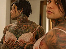 Мужчина проиграл спор и вставил в грудь силиконовые импланты