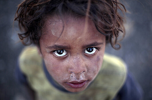 Йеменский кризис: три характеристики тяжелейшего в мире гуманитарного кризиса (NBC news, США)