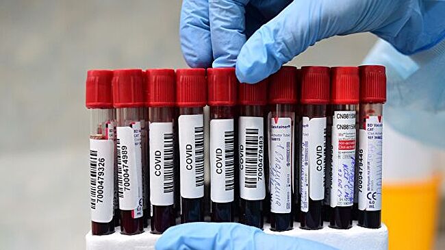 Число случаев COVID-19 в Саудовской Аравии за сутки побило рекорд