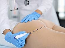 Россиянки отказываются от увеличения ягодиц после смерти известной блогерши