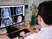 Ученые научились определять скорость старения мозга человека