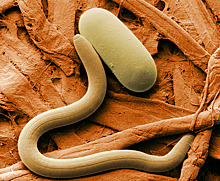Ученые начали использовать червей для выявления рака
