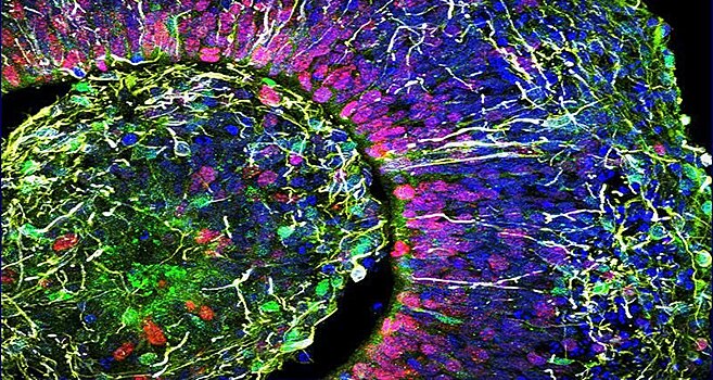 В лабораторных мини-мозгах появилась активность, похожая на человеческую