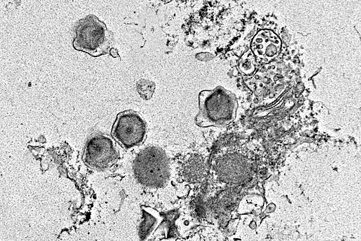 Ученые обнаружили сотни ранее неизвестных видов гигантских вирусов