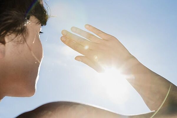 Солнечный ожог: как лечить и чем мазать, первая помощь | РБК Стиль