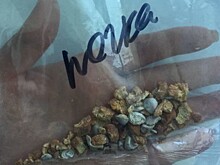 Врачи областной больницы провели операцию и спасли почку 71-летней женщине