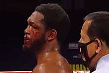 Боксер порвал губу сопернику апперкотом и победил