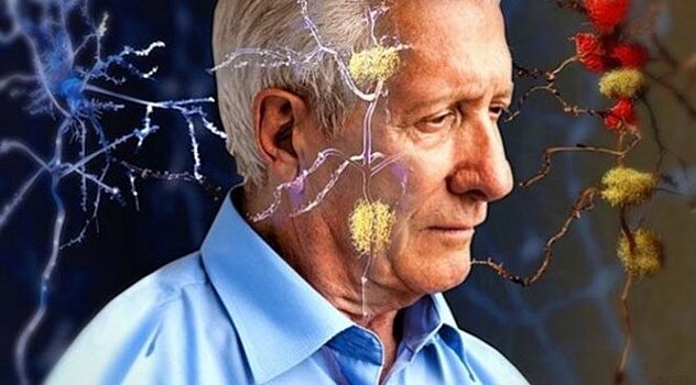 Учёные: Физическая активность снижает риск развития болезни Альцгеймера