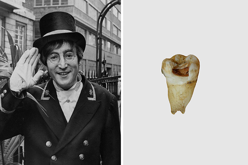 Зуб Джона Леннона, $31 000. Один из предусмотрительных стоматологов сохранил удаленный зуб одного из «битлов», а через много лет «реликвия» была продана на торгах. Кстати, приобрел зуб практикующий дантист Майкл Зук, разместивший «раритет от звезды» в своей клинике. А позже написал книгу о том, что вскоре ученые смогут воссоздавать людей с помощью оставшихся зубов. 