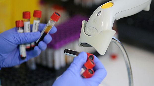 Хочется есть глину и нюхать выхлопные газы: девять признаков недостатка железа в организме