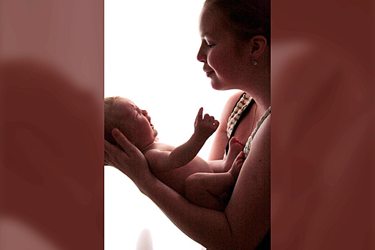 «Ума не хватило сделать аборт?»: врачи просили женщину отказаться от сына из-за патологии его лица