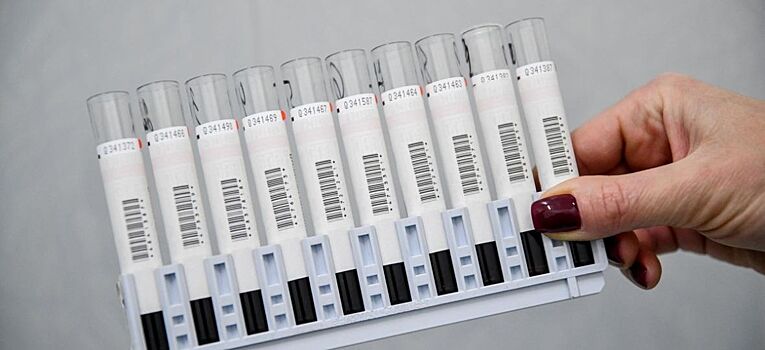 В России создали ПЦР-тест для быстрого выявления ВИЧ