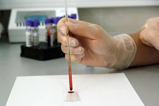 Казанцы могут сделать биохимическое исследование крови всего за 100 рублей