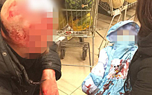 Водитель сбил и избил битой отца с младенцем в Москве