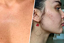 Блогер Дина Саева показала недостатки кожи на фото без макияжа