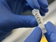 Эксперт объяснил отличия повторного заражения коронавирусом от рецидива