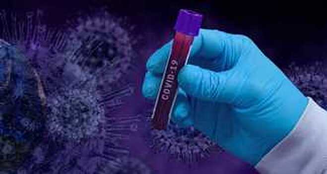 361 новый случай заражения коронавирусом выявлен на Вологодчине