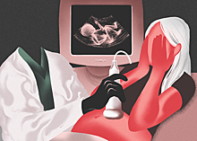 Мертвый груз: девушки рассказывают о том, как впервые сделали аборт
