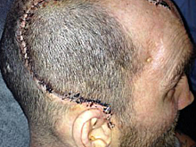 Что бывает от одного удара кулаком: шокирующая правда о физическом насилии