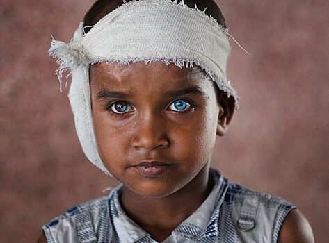 Наши глаза: что они скрывают