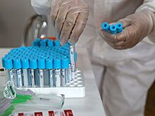 31 специалист был задействован в борьбе против COVID-19 от сборных России