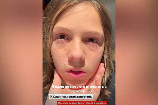 Жена Дмитрия Диброва пожаловалась на обострение аллергии сына