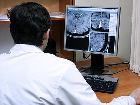 Опухоли мозга: что нужно знать, чтобы не пропустить болезнь