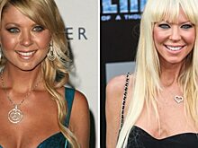 Как же это все произошло, ведь немного времени прошло: 10 звезд, которые растеряли свою красоту