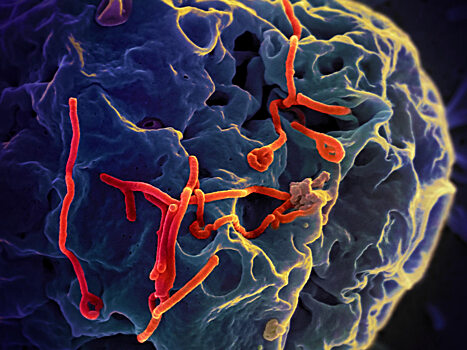 Найден человеческий белок, противодействующий вирусу Эбола