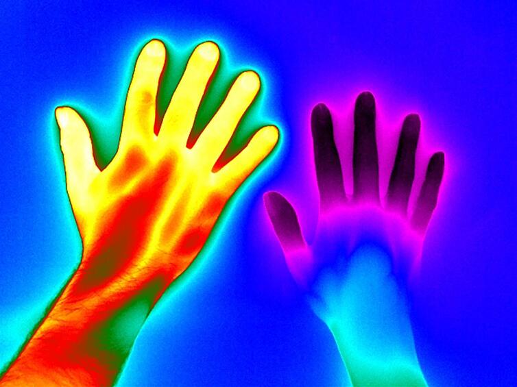 Эта фотография показывает температуру рук двух людей: слева - рука здорового человека; справа - с болезнью Рейно (очень холодные руки и ноги)