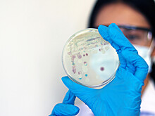 В Шотландии нашли древнейший гриб возрастом 407 миллионов лет