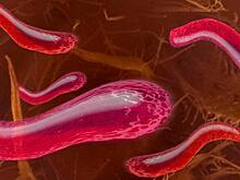 Кишечные бактерии —причина развития атеросклероза